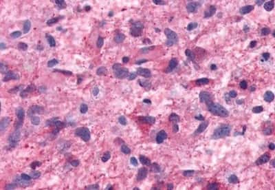 Immunohistochemistry-Paraffin: 5-HT7 Antibody [NBP3-14527]